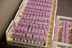 Blood sample vials prepared for testing at the Texas Department of State Health Services Laboratory during the West Texas measles outbreak.