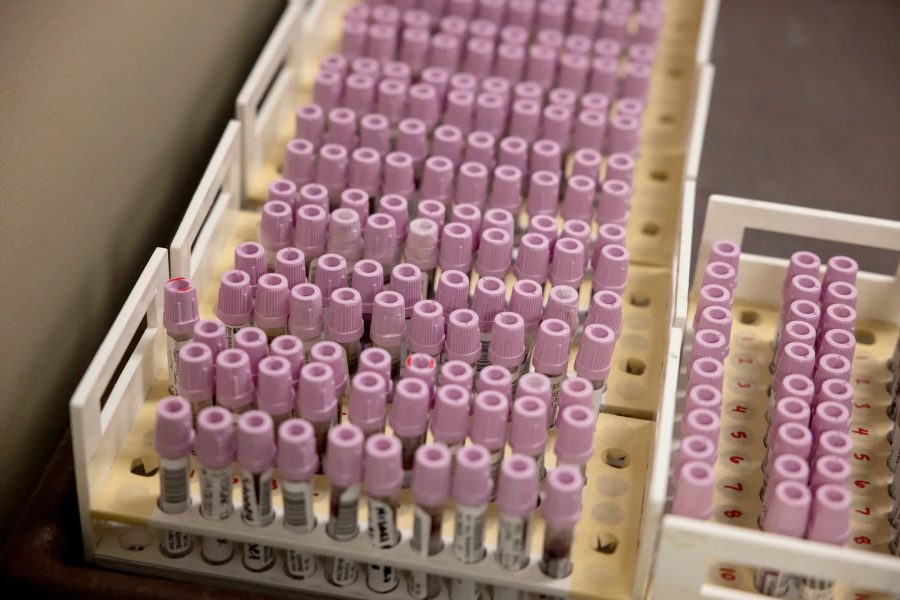 Blood sample vials prepared for testing at the Texas Department of State Health Services Laboratory during the West Texas measles outbreak.