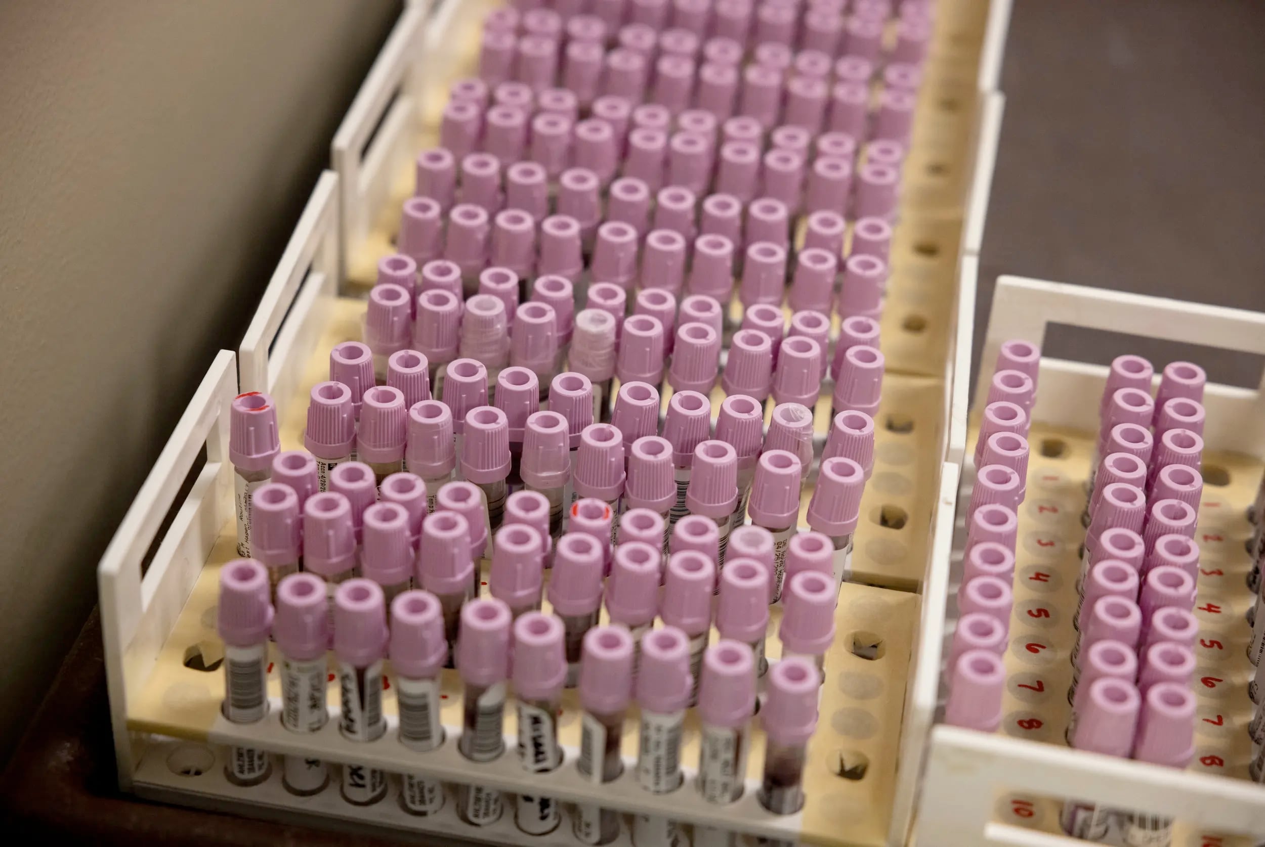 State health officials declare West Texas measles outbreak over